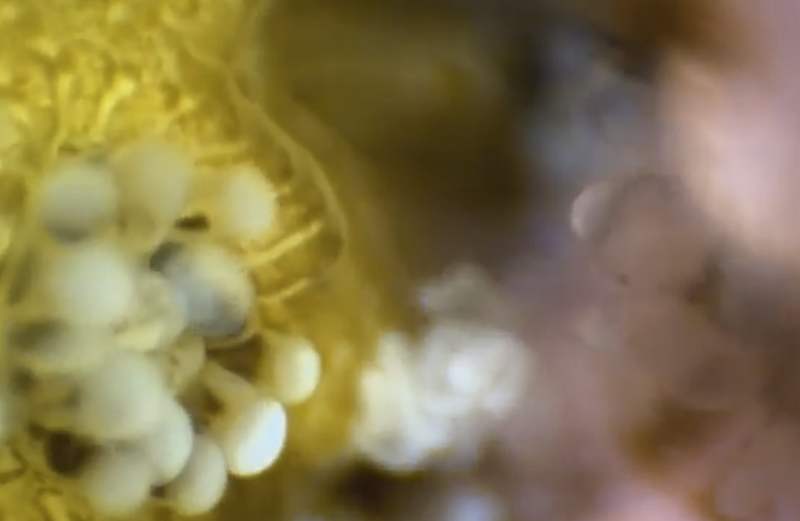 Illustration for article titled This Never Before Seen Microscopic Deep Sea Footage Is Other Worldly